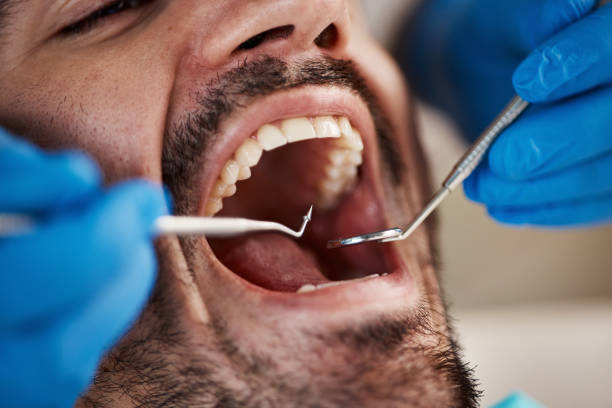 Best Emergency Treatment for Oral Infections in Giddings, TX